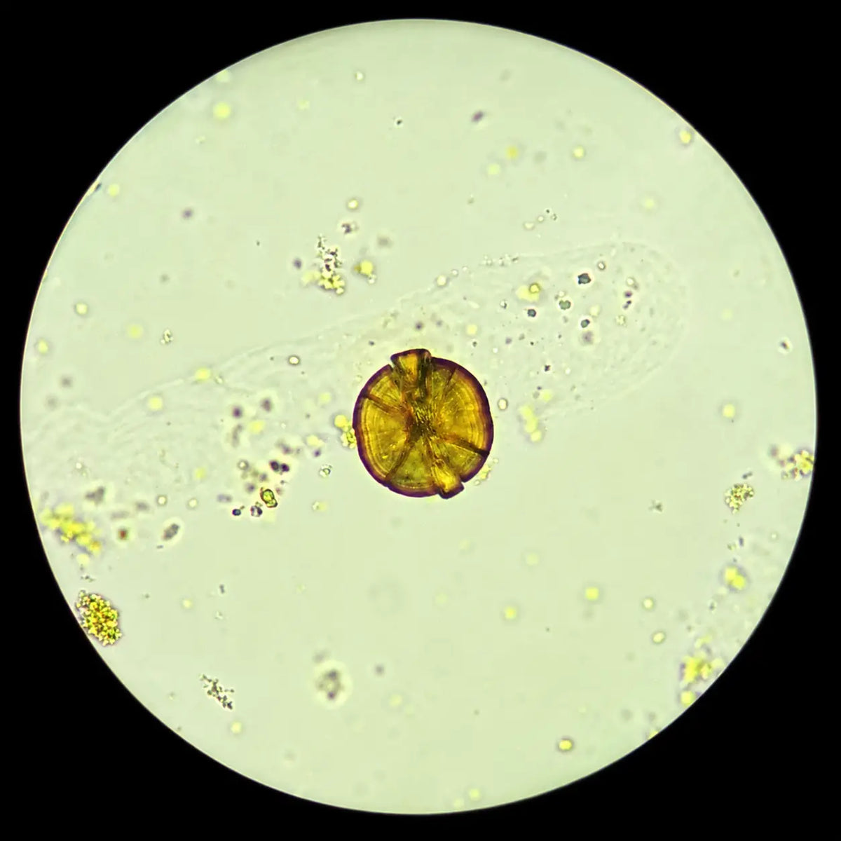 CaHMB (Calcium Beta-Hydroxy Beta-Methylbutyrate)