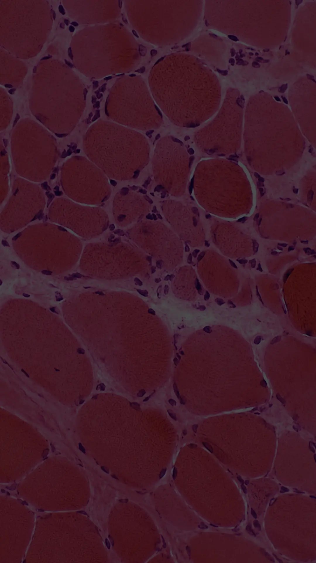 HMB + Creatine — HMB: Less Breakdown, More Retained
